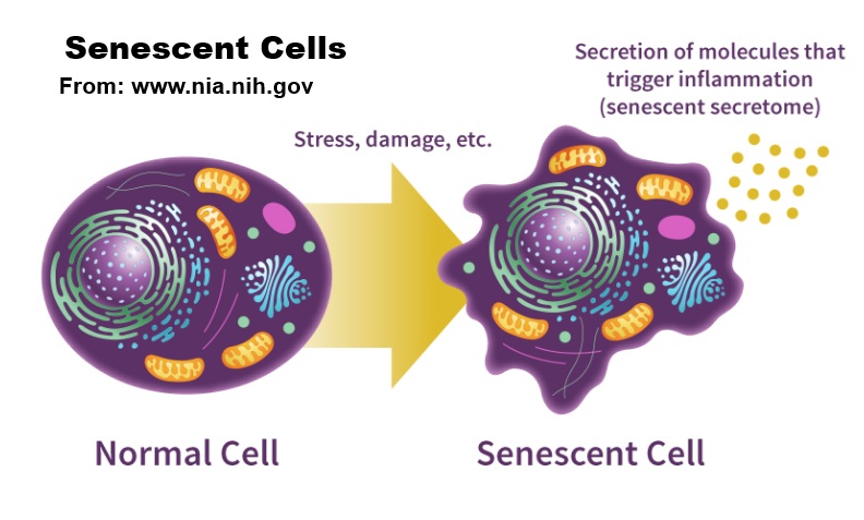 scenescent-cell-nih-source-pic.jpg
